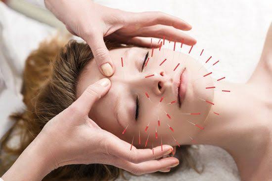 PG DIPLOMA IN ACUPUNCTURE