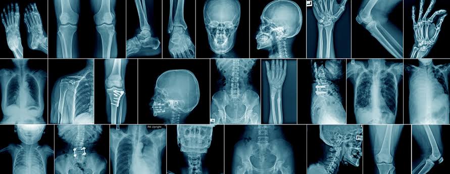 ADVANCE DIPLOMA IN X -RAY TECHNOLOGY